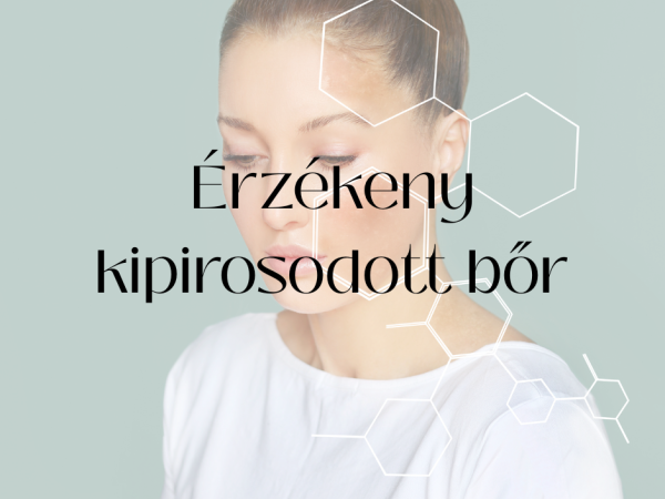 Érzékeny kipirosodott bőr kezelése
