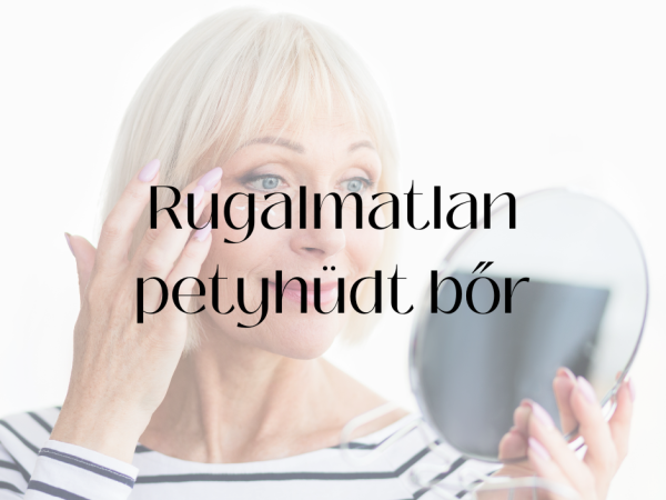 Rugalmatlan petyhüdt bőr kezelése