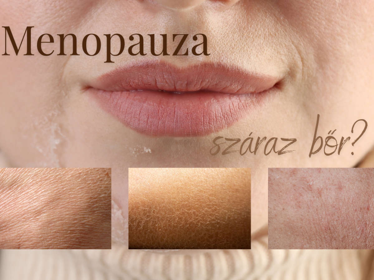 Börszárazság posztmenopauzában Börszárazság posztmenopauzában